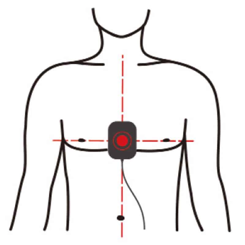 Paso 1: Colocar el desfibrilador en el pecho del paciente